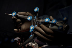 Con apoyo de la IA, ISSSTEP realiza primera cirugía de rodilla